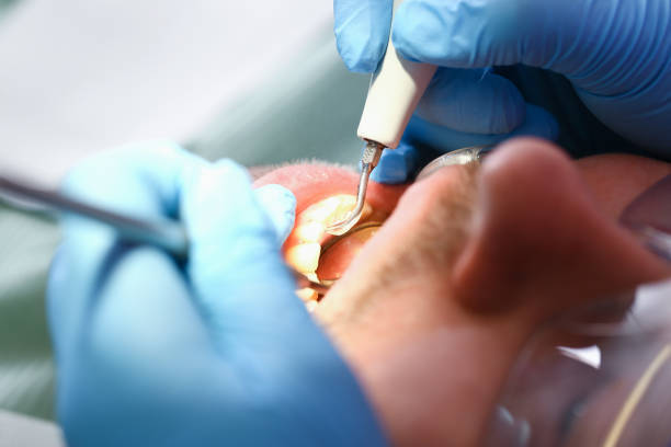 Best Cosmetic Emergency Dentistry in Rossvle, IL